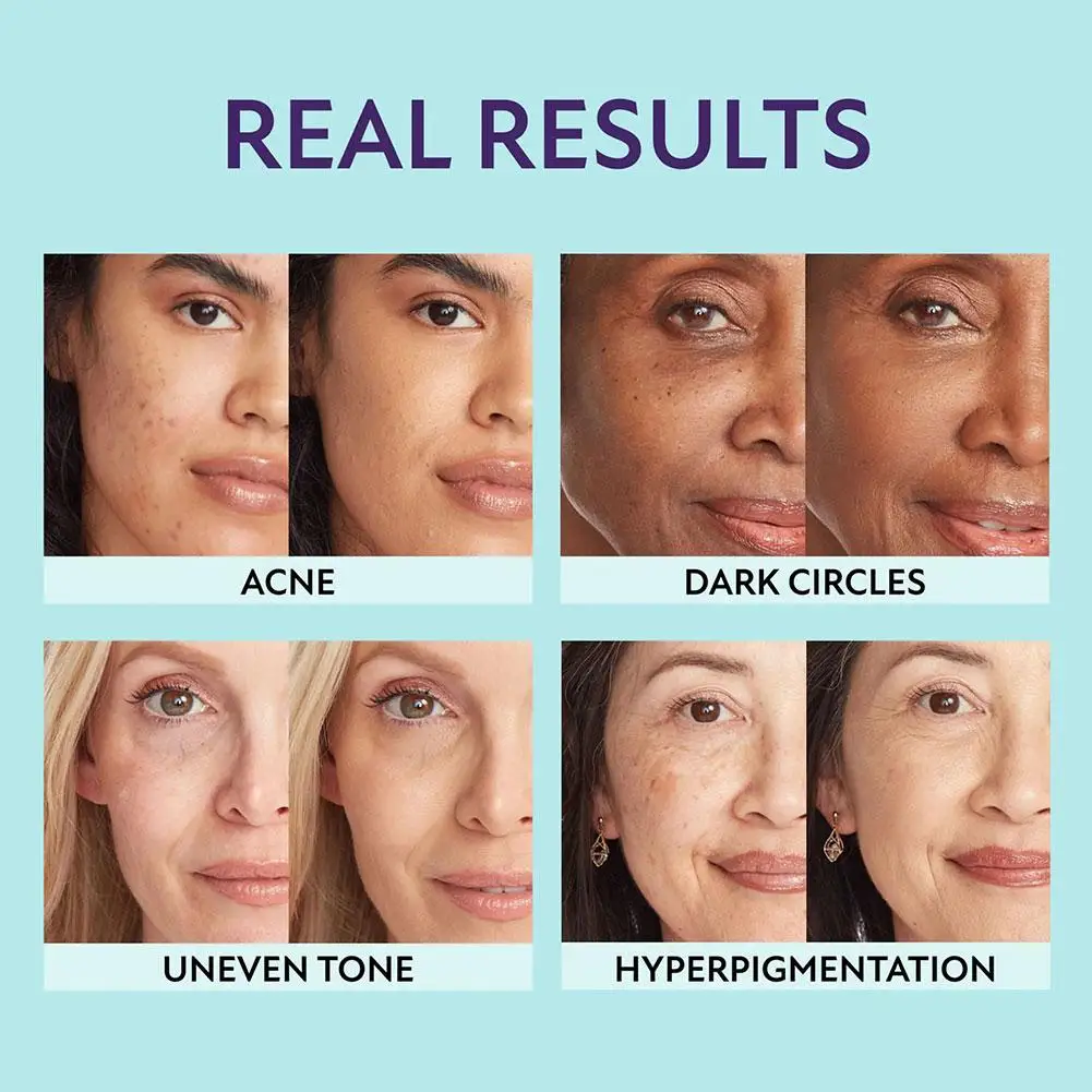 3 in 1 Body and Face Foundation | Concealer, Bronzer and Foundation