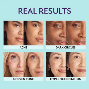 3 in 1 Body and Face Foundation | Concealer, Bronzer and Foundation