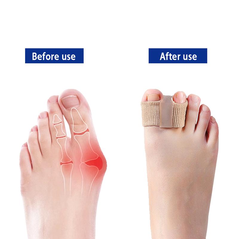 Premium Elastic Toe Separators – Comfortable Pain Relief & Alignment